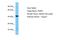 PDZ Domain Containing 3 antibody, A12097, Boster Biological Technology, Western Blot image 