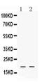 Defensin Alpha 1B antibody, A10546, Boster Biological Technology, Western Blot image 