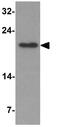 Teratocarcinoma-Derived Growth Factor 1 antibody, GTX31511, GeneTex, Western Blot image 