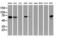 Epsin 2 antibody, LS-C173746, Lifespan Biosciences, Western Blot image 