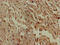 N-Acylsphingosine Amidohydrolase 1 antibody, CSB-PA619774LA01HU, Cusabio, Immunohistochemistry frozen image 