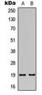 Trafficking Regulator Of GLUT4 (SLC2A4) 1 antibody, orb315736, Biorbyt, Western Blot image 