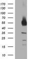 Tyrosine Hydroxylase antibody, CF506553, Origene, Western Blot image 