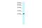 Chromatin modification-related protein MEAF6 antibody, A08893, Boster Biological Technology, Western Blot image 