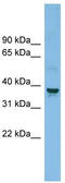 Solute Carrier Family 30 Member 3 antibody, TA333995, Origene, Western Blot image 