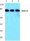 A-Kinase Anchoring Protein 10 antibody, PA5-36131, Invitrogen Antibodies, Western Blot image 