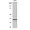 Prostate Transmembrane Protein, Androgen Induced 1 antibody, LS-C385561, Lifespan Biosciences, Western Blot image 