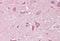 Neural Cell Adhesion Molecule 2 antibody, GTX89311, GeneTex, Immunohistochemistry paraffin image 