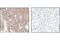 Tyrosine antibody, 9416S, Cell Signaling Technology, Immunohistochemistry paraffin image 