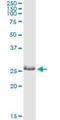 Zinc Finger Protein 266 antibody, H00010781-M05, Novus Biologicals, Immunoprecipitation image 