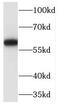 MARCKS Like 1 antibody, FNab05008, FineTest, Western Blot image 