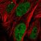 Zinc Finger Protein 32 antibody, HPA039148, Atlas Antibodies, Immunocytochemistry image 