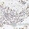 Ribonuclease P/MRP Subunit P30 antibody, A8479, ABclonal Technology, Immunohistochemistry paraffin image 