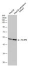 Aldehyde Dehydrogenase 2 Family Member antibody, GTX101429, GeneTex, Western Blot image 