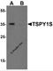 Testis Specific Protein Y-Linked 1 antibody, 7123, ProSci, Western Blot image 