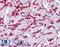 Potassium Voltage-Gated Channel Subfamily A Member 10 antibody, LS-B4576, Lifespan Biosciences, Immunohistochemistry paraffin image 