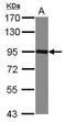 Nectin Cell Adhesion Molecule 3 antibody, GTX103654, GeneTex, Western Blot image 