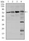 Forkhead Box O1 antibody, GTX60558, GeneTex, Western Blot image 