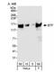 BCL2 Associated Transcription Factor 1 antibody, NB100-1704, Novus Biologicals, Western Blot image 