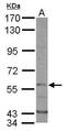 Dual Specificity Tyrosine Phosphorylation Regulated Kinase 1B antibody, GTX102623, GeneTex, Western Blot image 