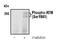 ATM Serine/Threonine Kinase antibody, MA5-15185, Invitrogen Antibodies, Western Blot image 