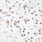 Cyclin Dependent Kinase 1 antibody, STJ114288, St John
