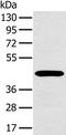MAGE Family Member A10 antibody, PA5-50444, Invitrogen Antibodies, Western Blot image 