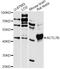 Actin Like 7B antibody, LS-C748208, Lifespan Biosciences, Western Blot image 