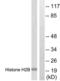 Histone H2B antibody, LS-B7717, Lifespan Biosciences, Western Blot image 