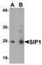 Gem Nuclear Organelle Associated Protein 2 antibody, NBP1-77177, Novus Biologicals, Western Blot image 