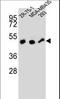 Zinc Finger Protein 30 antibody, LS-C160772, Lifespan Biosciences, Western Blot image 