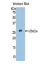 Perilipin-2 antibody, LS-C298506, Lifespan Biosciences, Western Blot image 