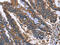 Integrin Linked Kinase antibody, CSB-PA087041, Cusabio, Immunohistochemistry paraffin image 