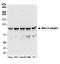 Adaptor Related Protein Complex 2 Subunit Beta 1 antibody, A304-718A, Bethyl Labs, Western Blot image 