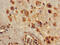 Purinergic Receptor P2X 4 antibody, CSB-PA859513LA01HU, Cusabio, Immunohistochemistry paraffin image 