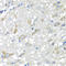 Carbonyl Reductase 3 antibody, LS-C349230, Lifespan Biosciences, Immunohistochemistry frozen image 