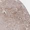 Solute Carrier Family 30 Member 6 antibody, NBP2-31673, Novus Biologicals, Immunohistochemistry paraffin image 