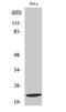 DIRAS Family GTPase 1 antibody, STJ92718, St John