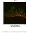 GLI Family Zinc Finger 2 antibody, PA5-40443, Invitrogen Antibodies, Immunohistochemistry frozen image 
