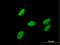 Zinc Finger Protein 599 antibody, H00148103-B01P, Novus Biologicals, Immunofluorescence image 