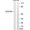 Solute Carrier Family 24 Member 4 antibody, A06104, Boster Biological Technology, Western Blot image 