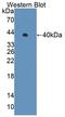 Protein Phosphatase 1 Regulatory Subunit 15A antibody, LS-C702170, Lifespan Biosciences, Western Blot image 