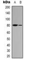 MRE11 Homolog, Double Strand Break Repair Nuclease antibody, orb338997, Biorbyt, Western Blot image 