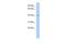 Sperm Associated Antigen 6 antibody, A07899, Boster Biological Technology, Western Blot image 