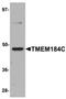 Transmembrane Protein 184C antibody, orb75397, Biorbyt, Western Blot image 