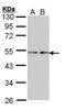 Fascin Actin-Bundling Protein 1 antibody, PA5-21319, Invitrogen Antibodies, Western Blot image 