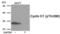 Cyclin D1 antibody, PA5-37487, Invitrogen Antibodies, Western Blot image 