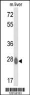 ETHE1 Persulfide Dioxygenase antibody, 62-374, ProSci, Western Blot image 