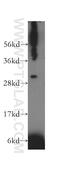 TRAV20 antibody, 13132-1-AP, Proteintech Group, Western Blot image 