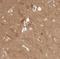 BAALC Binder Of MAP3K1 And KLF4 antibody, NBP1-89443, Novus Biologicals, Immunohistochemistry frozen image 